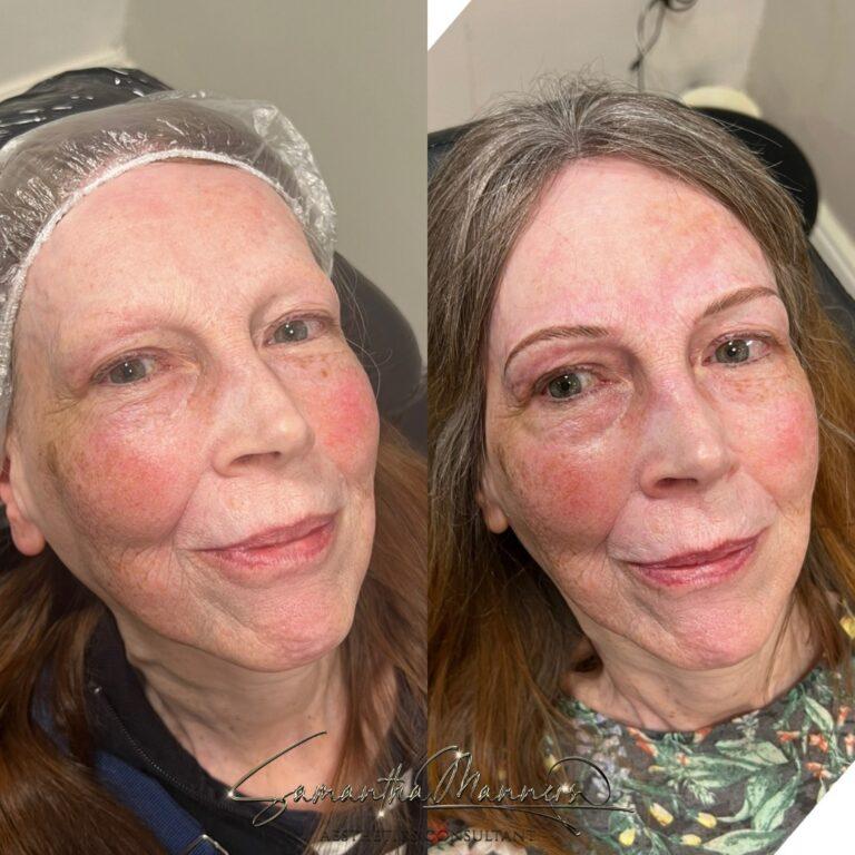Cosmetic 10 cosmetic 12