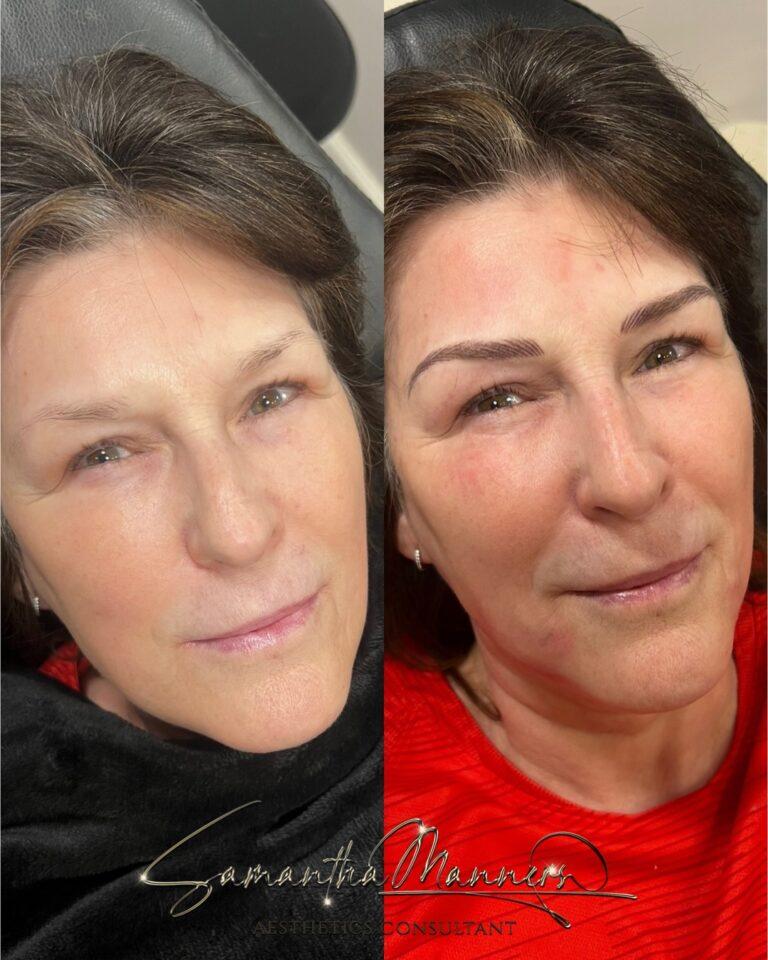 Cosmetic 5 cosmetic33