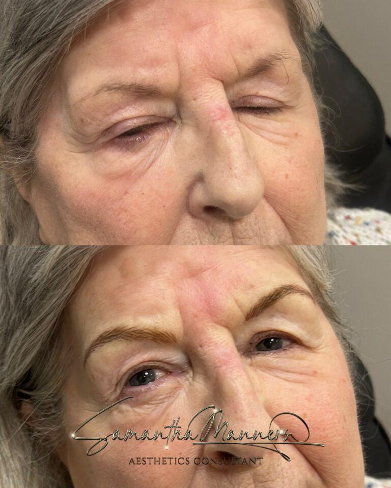 Cosmetic 3 cosmetic45